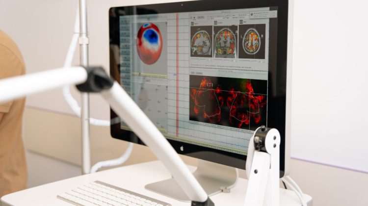 Sprijin pentru persoanele cu epilepsie. La IMU a fost inaugurat Centrul național de epileptologie