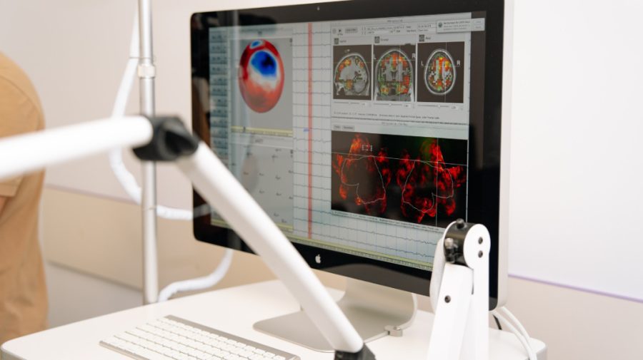 Sprijin pentru persoanele cu epilepsie. La IMU a fost inaugurat Centrul național de epileptologie