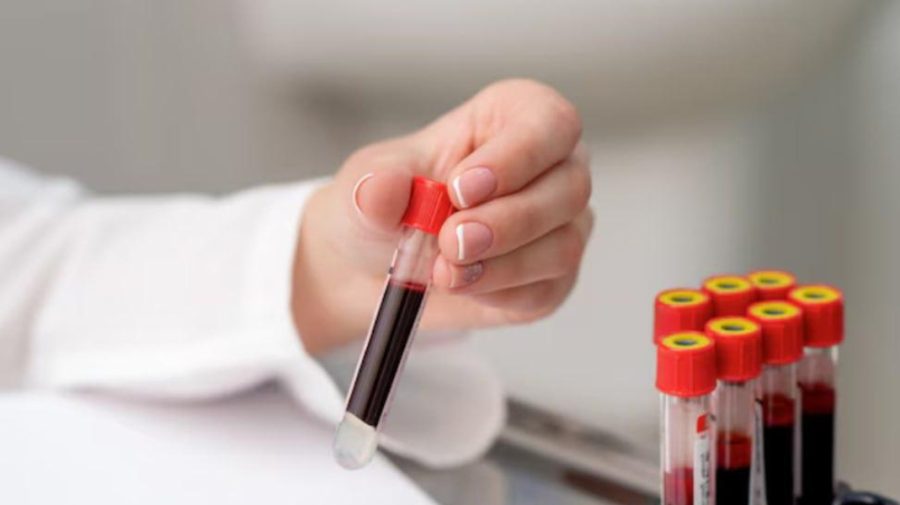 Descoperire medicală. Un test de sânge ar putea depista sindromul oboselii cronice