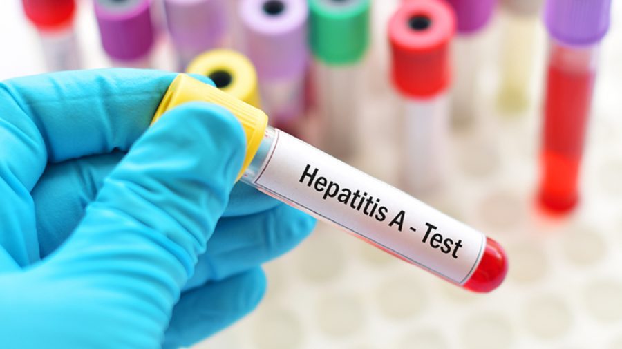 Focar de hepatită A în șapte localităţi din România. Peste 130 de persoane s-au îmbolnăvit