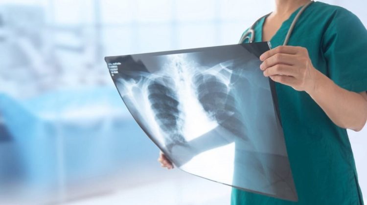 Pneumonia a provocat peste 1000 de decese în Moldova, în 2024. Printre victime sunt și copii