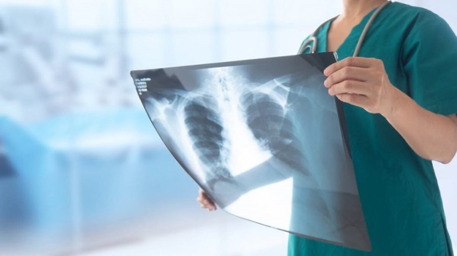 Pneumonia a provocat peste 1000 de decese în Moldova, în 2024. Printre victime sunt și copii